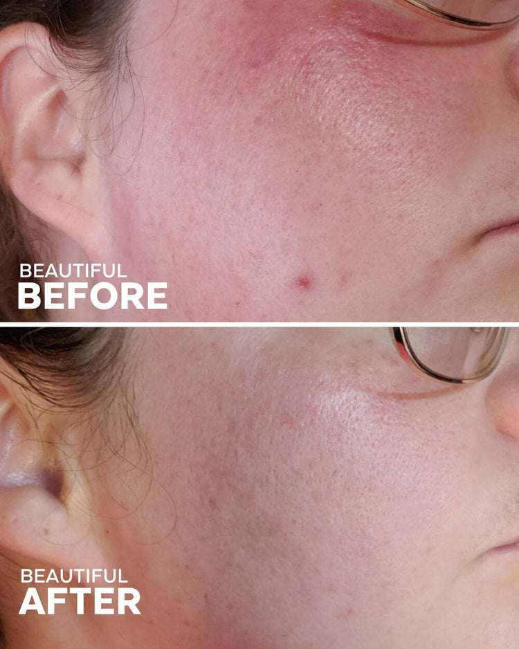 Summer Best-Sellers Bundle Three Ships Natural Vegan Cruelty-free Skincare