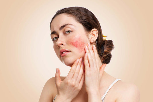 What Causes Hypersensitive Skin and What Can You Do About It? - Three Ships